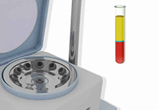 Platelet Rich plasma